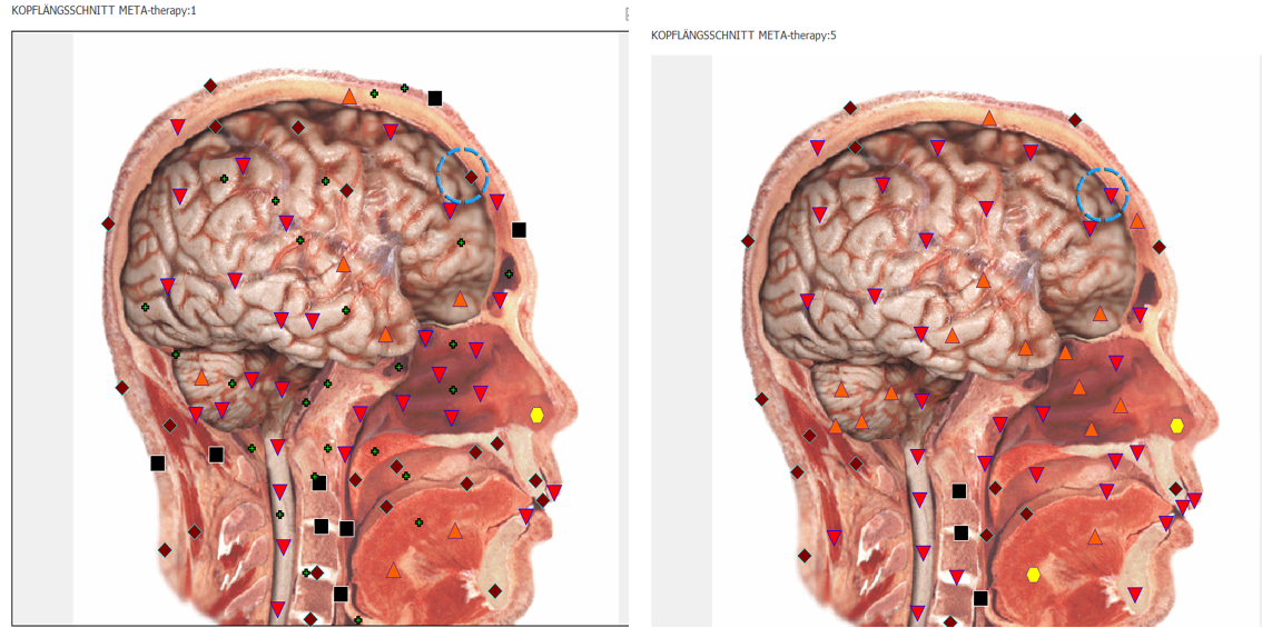 Bioresonanz Kopfvergleich zeigt verschiedene Markierung mit unterschiedlichen Farben